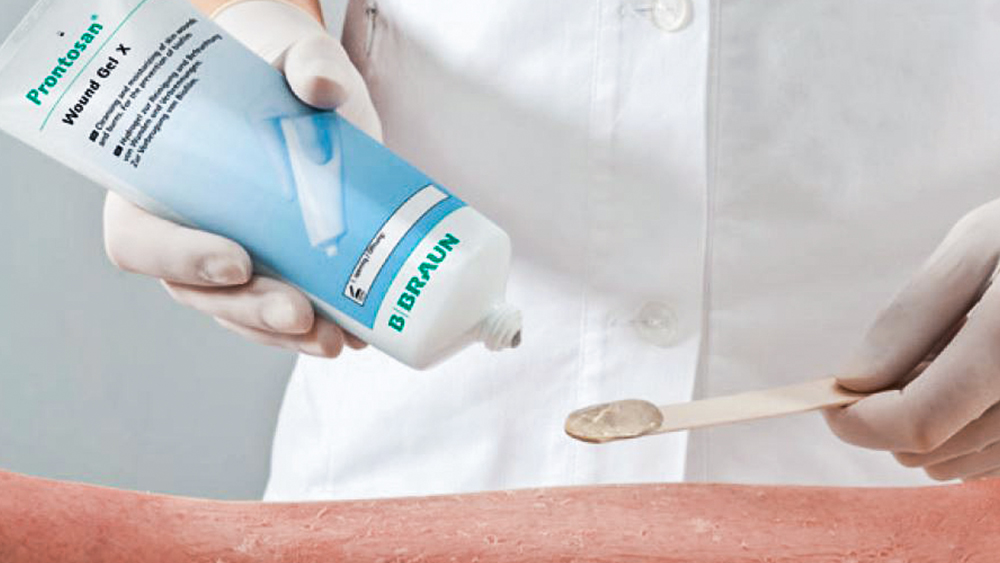 Cận cảnh bàn tay đeo găng đang cầm tuýp Prontosan® và bôi gel lên vết bỏng