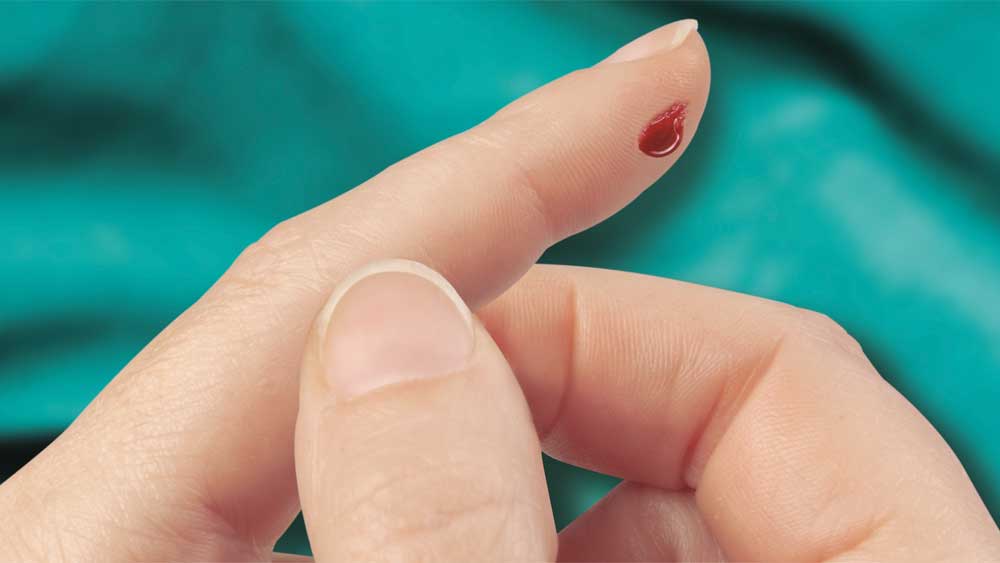 Đầu ngón tay bị chảy máu