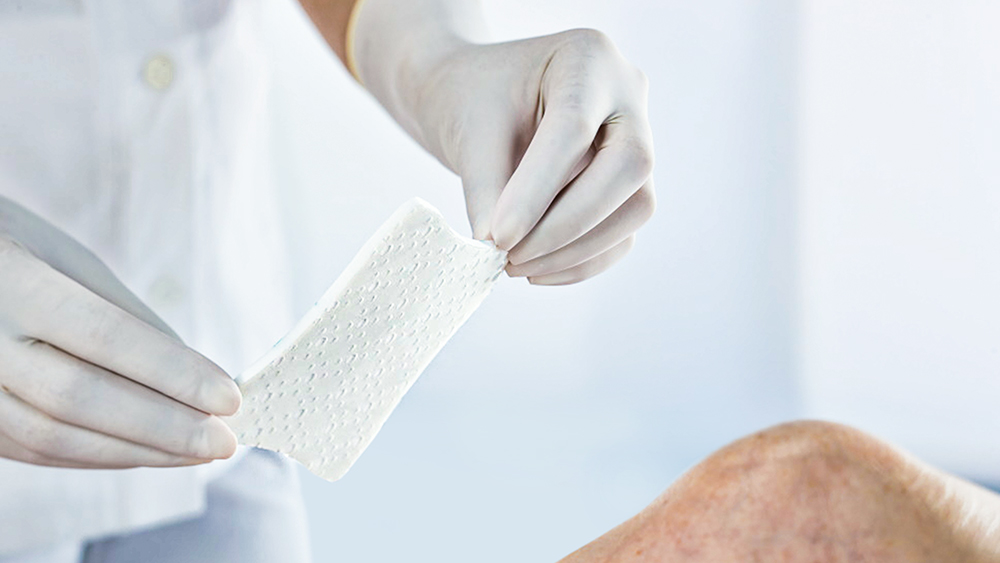 thạch cao bị kẹt trên đầu gối với hai tay đeo găng tay